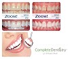 Visit Teeth Whitening Clinics Orland Park & consult Cosmetic Dentist to Regain Smile