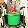 Touching!!! Meet The Nigerian Girl Born With No Arms Or Legs Who Lives In A Plastic Bowl