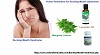 Home Remedies for Burning Mouth Syndrome
