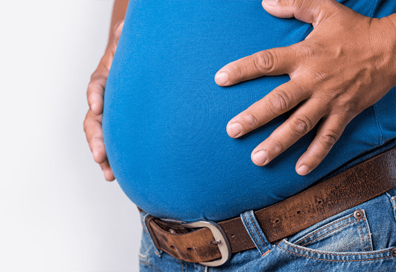 Medical tourism for bariatric surgery