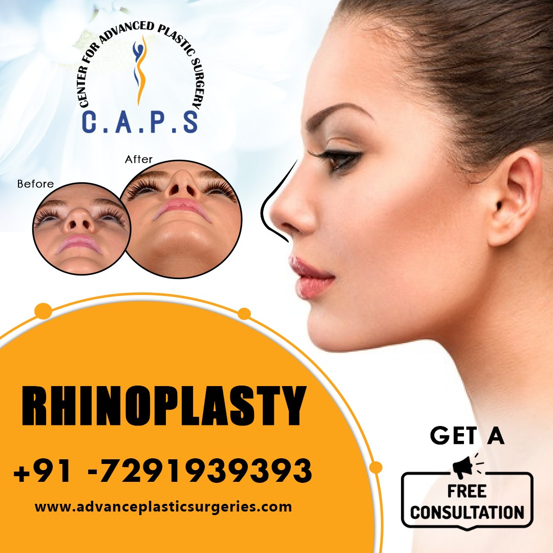 Rhinoplasty Surgery in Delhi