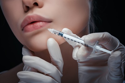 Enhance Your Smile with Expert Lip Injections