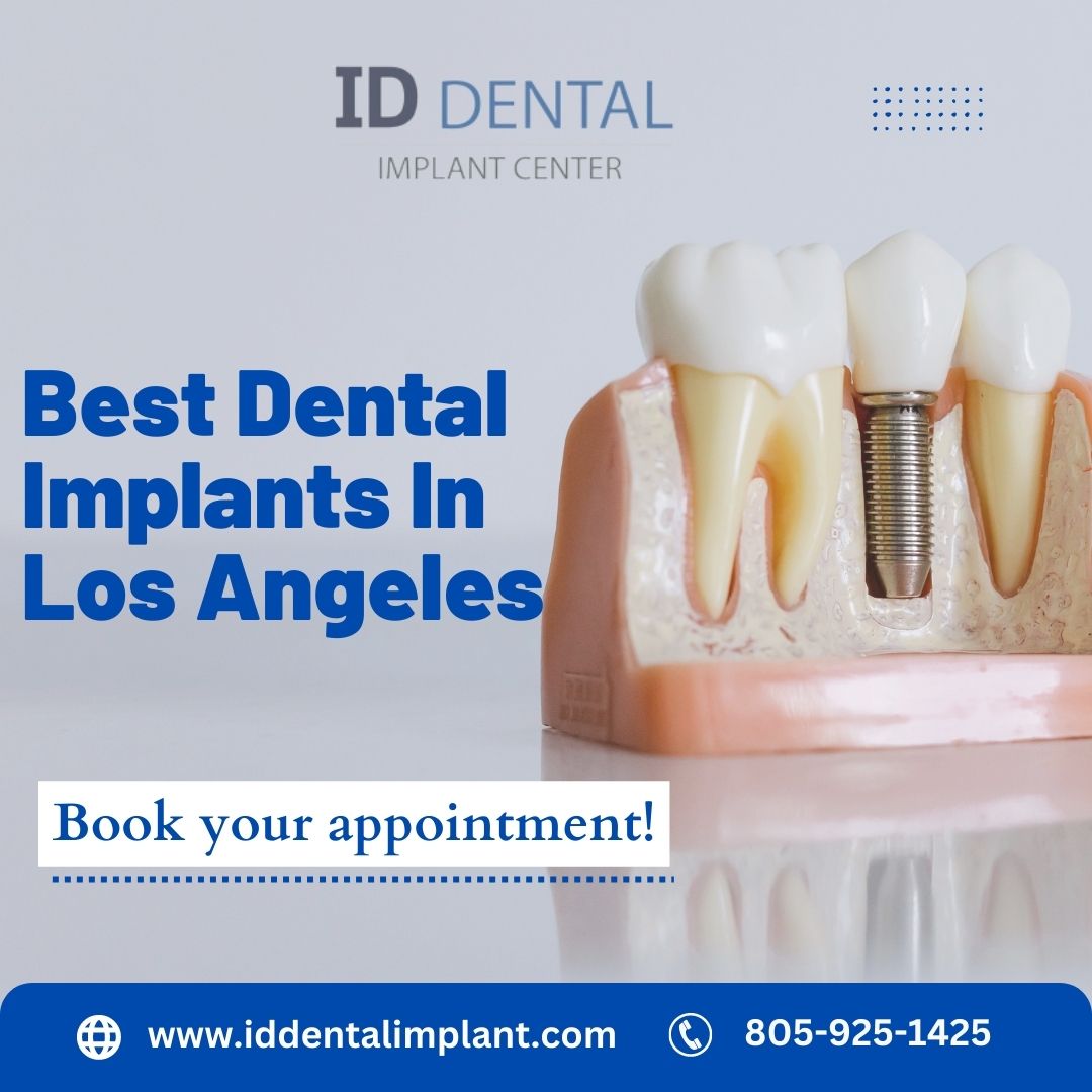 Best Dental Implants Los Angeles  - ID Dental and Implant Center
