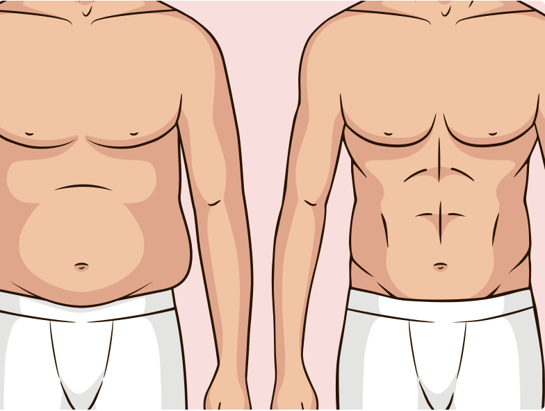 Augmentation mammoplasty Lahore