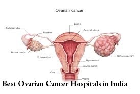 Best Hospital for Ovarian Cancer Treatment in India Logo