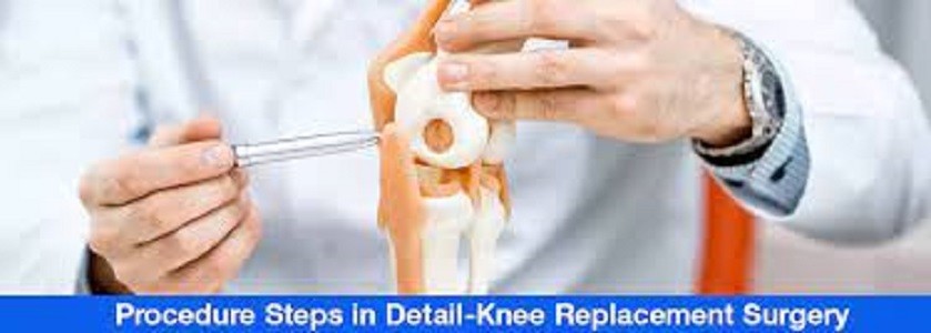 Knee Replacement Surgery Logo
