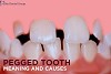 PEGGED TEETH- MEANING, CAUSES AND TREATMENT Logo