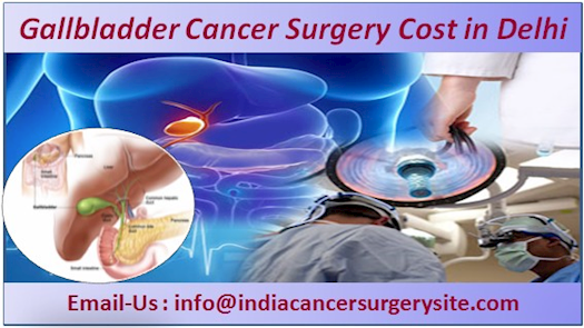  Gallbladder Cancer Surgery Cost in Delhi