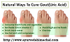 Natural Ways To Cure Gout (Uric Acid)