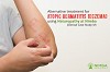 [Case Study IV] Alternative treatment for Atopic Dermatitis (Eczema) using Naturopathy at Nimba