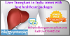 Liver Transplant in India comes with best healthcare packages