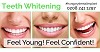 Teeth Whitening Treatment in London