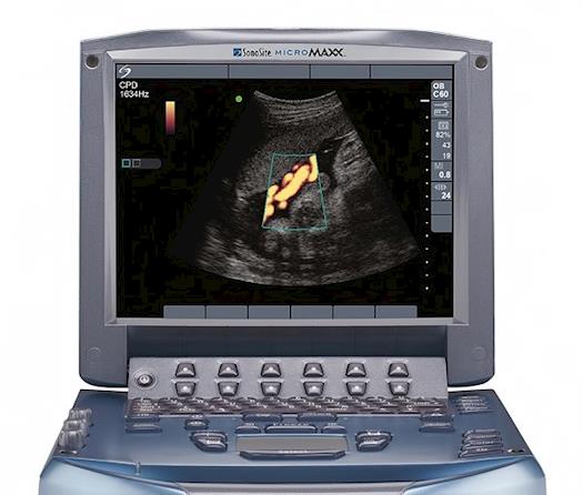 MicroMaxx: Sonosite ultrasound system