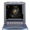 MicroMaxx: Sonosite ultrasound system