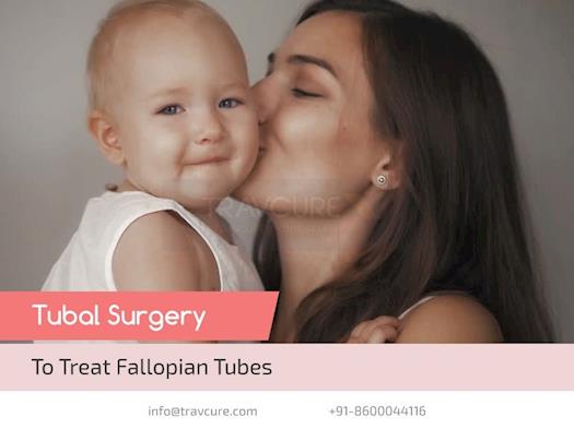  Complete Guide About Tubal Surgery