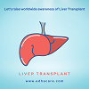 Liver Transplant