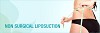 Remove Excess Fat With Non-Surgical Liposuction Services