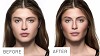 Looking For Facial Contouring Surgery