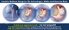 Gastric Balloon Surgery: Its Advantages, Risks and Success Rate