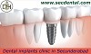 Dental implants surgery clincs in Secunderabad