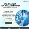 Rare Kidney Diseases Market | Membranous Nephropathy | Market Size - 2035