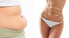 It's All About The Abdominal Liposuction
