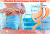 Affordable Bariatric Surgery to Reduce Weight