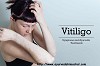 Arogyam Pure Herbs Kit For Vitiligo