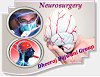 Neurological Surgery at minimal Cost by Best Neurosurgeons in India