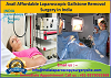 Avail Affordable Laparoscopic Gallstone Removal Surgery in India