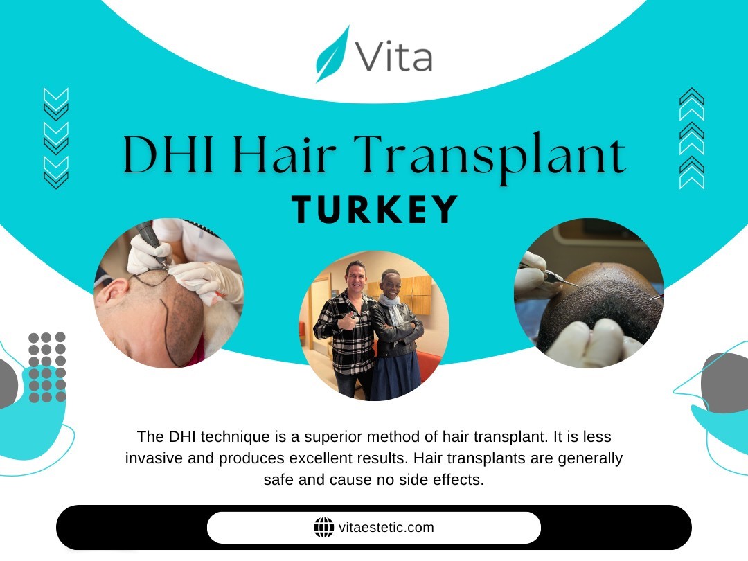 DHI Hair Transplant Turkey