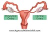 Arogyam Pure Herbs Kit For PCOS/PCOD To Cure PCOS/PCOD Problem