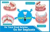 Smile Delhi The Dental Clinic - Best Place for Dental Implants in India