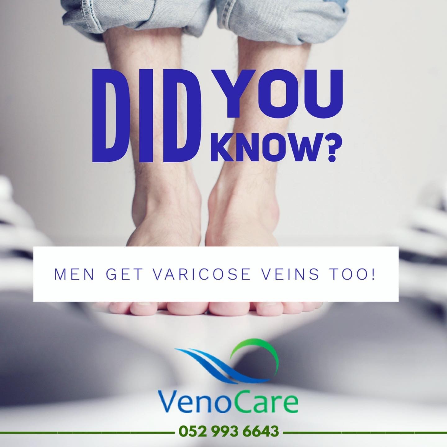 Men Varicose Veins