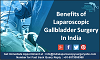 Laparoscopic Gallbladder Surgery Benefits in India: Too Good to Believe 