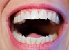 Desired Smiles: One Stop Solution for All Your Gum Problems.