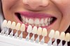 Best cosmetic dentist in koramangala – MydentistNow Complete Dental Solution 