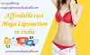 Quality mega liposuction in India at Affordable Rates