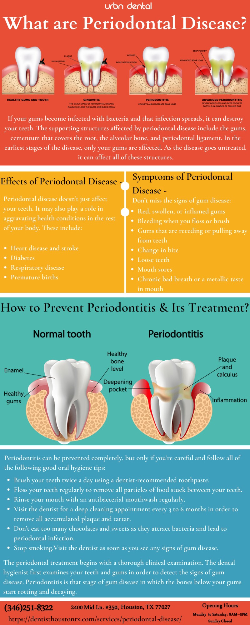 What are Periodontal Disease?