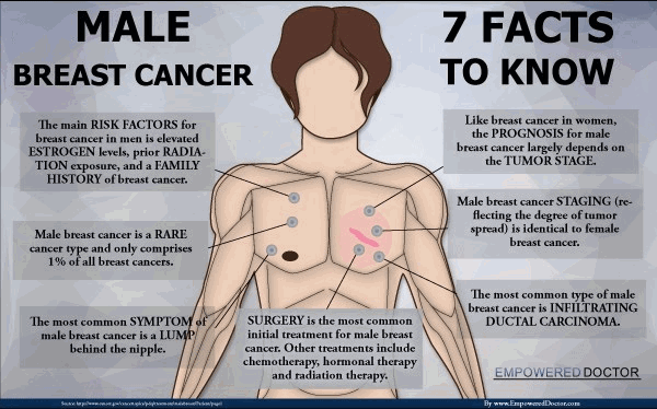 Male Breast Cancer - 7 Facts to Know