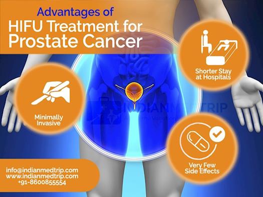 Advantages of HIFU Treatment for Prostate Cancer