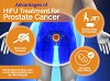 Advantages of HIFU Treatment for Prostate Cancer