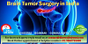 How long does it take to remove a meningioma? 