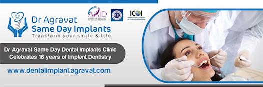 Dr Agravat Same Day Dental Implants Cost Clinic in Ahmedabad Gujarat India