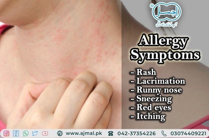 Allergy Symptoms and Treatment