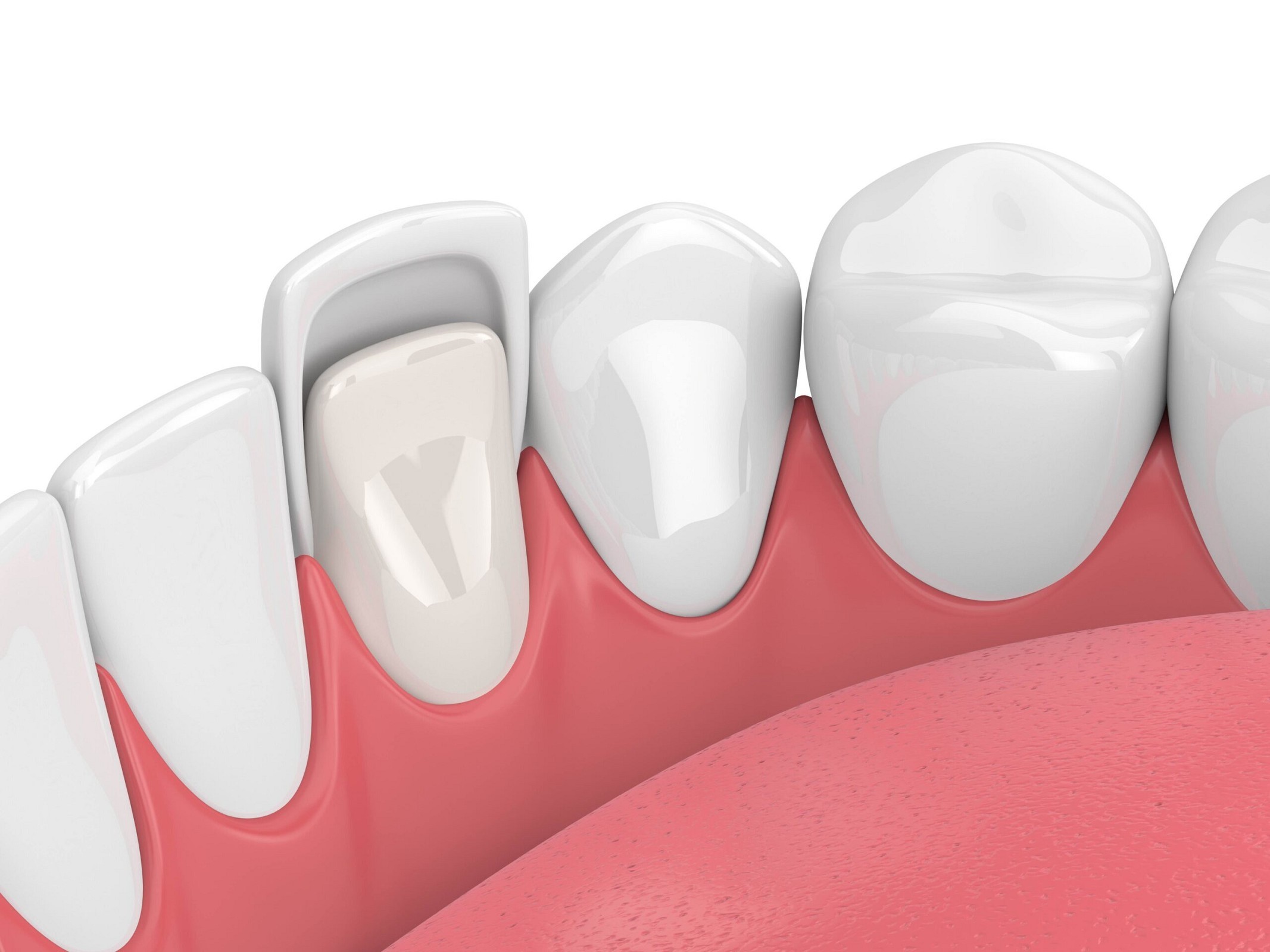 Rielo Dental Hialeah
