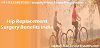 Quality Hip Replacement Surgery in India