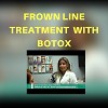 Frown lines best treatment