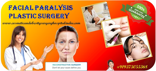 Facial Paralysis Surgery Cost in India :Top Plastic Surgeons