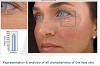 Laser Treatments for Your Skin - Dr. Sinha